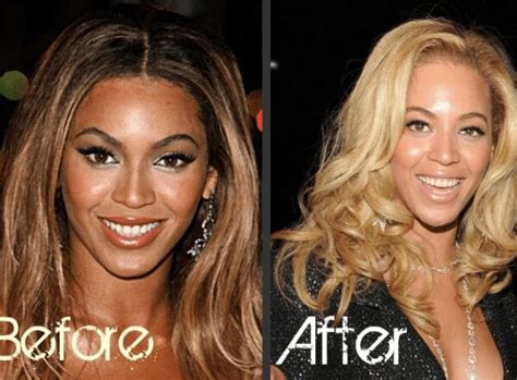 beyoncé before and after bleach|beyoncé skin color evolution.